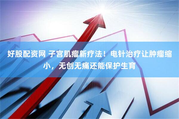 好股配资网 子宫肌瘤新疗法！电针治疗让肿瘤缩小，无创无痛还能保护生育